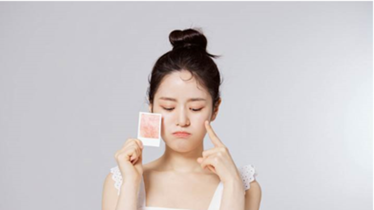 여름 이후 복구 안 된 피부, 늦기 전에 관리하려면?
